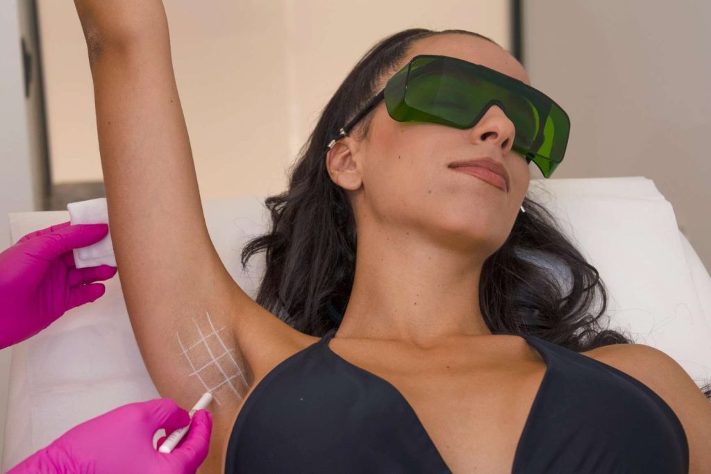 Κάθε πότε γίνονται οι συνεδρίες laser και πόσο διαρκεί το συνολικό πλάνο;