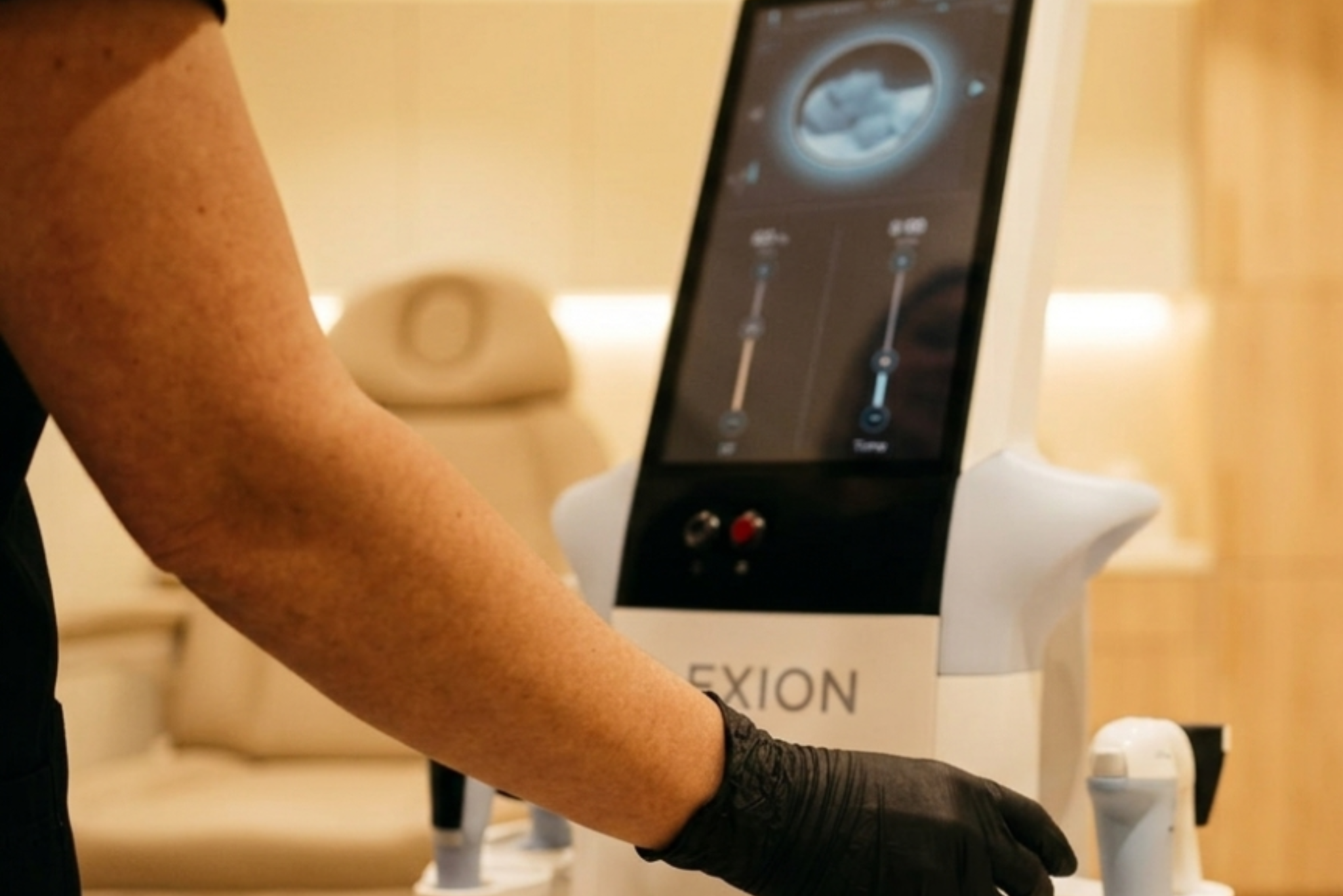 Ρύθμιση της συσκευής Exion RF Face πριν τη θεραπεία